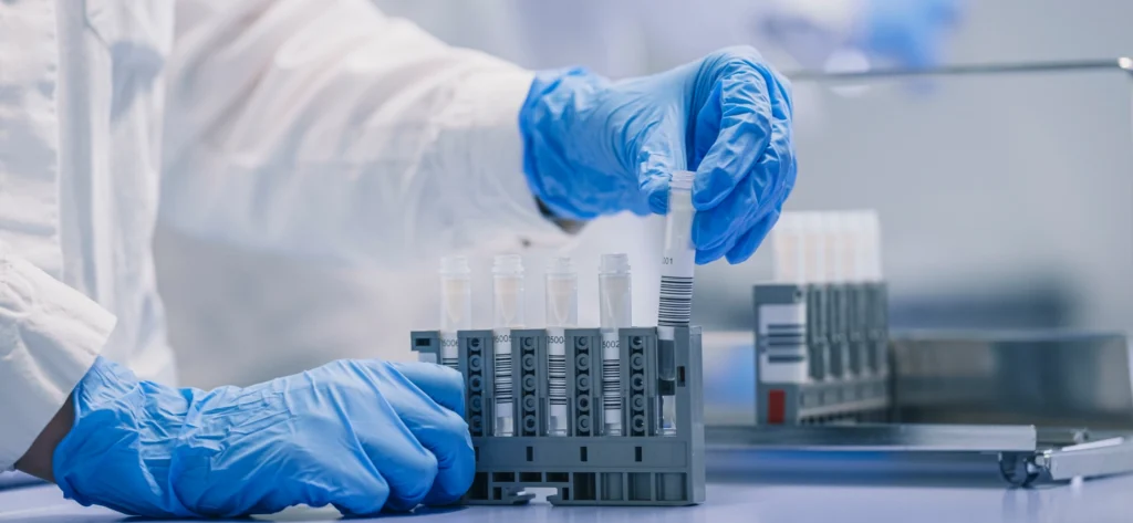 Eine Person, die blaue Handschuhe und einen Laborkittel trägt, stellt in einer Laborumgebung ein Reagenzglas in ein Gestell mit mehreren anderen Reagenzgläsern und bereitet Proben für die Begleitdiagnostik vor.